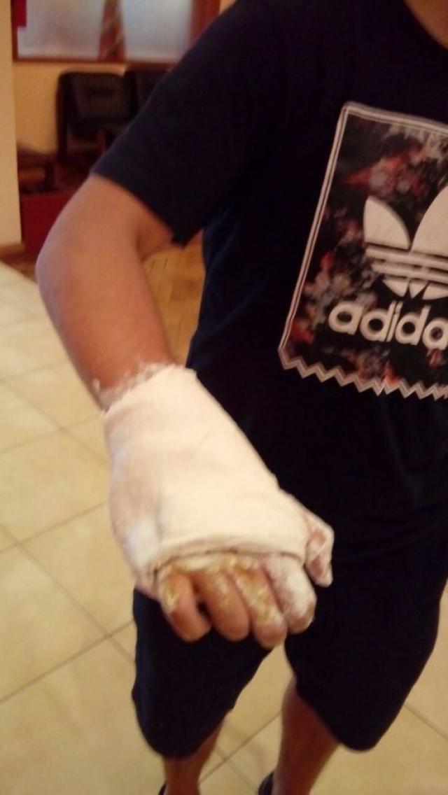 Gerbaudo se fractur� y estar� 45 d�as afuera